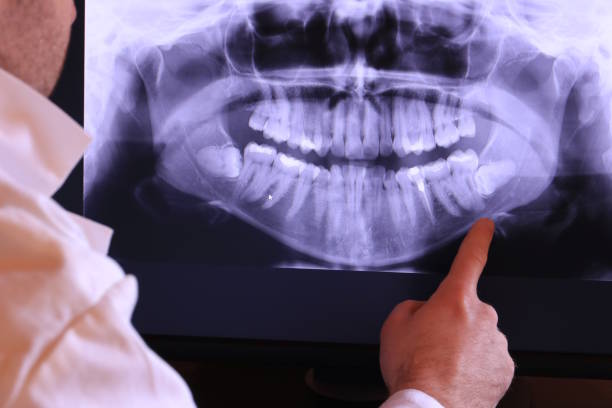 Best Emergency Treatment for Dental Infections or Abscesses in Taylors, SC