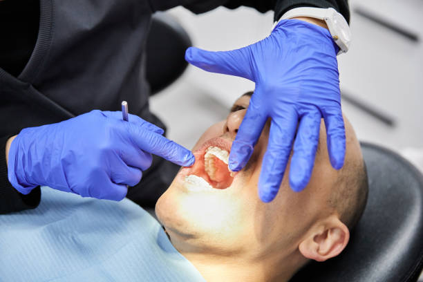Best Emergency Root Canal Treatment in Taylors, SC